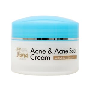 Lady Diana Acne and Acne Scar Cream, 80gm - Image 1